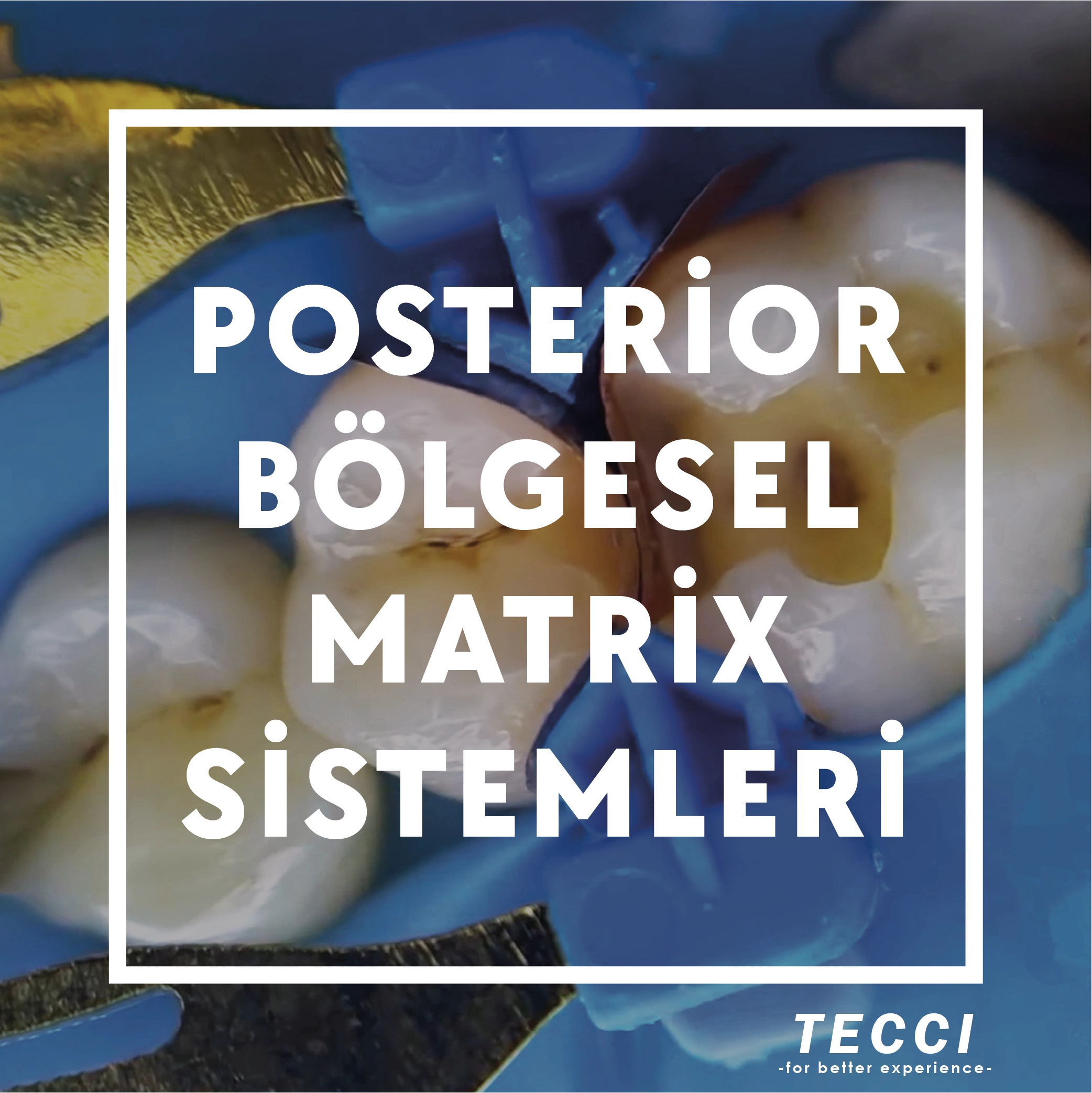 Tecci Posterior Bölgesel Matrix Sistemleri