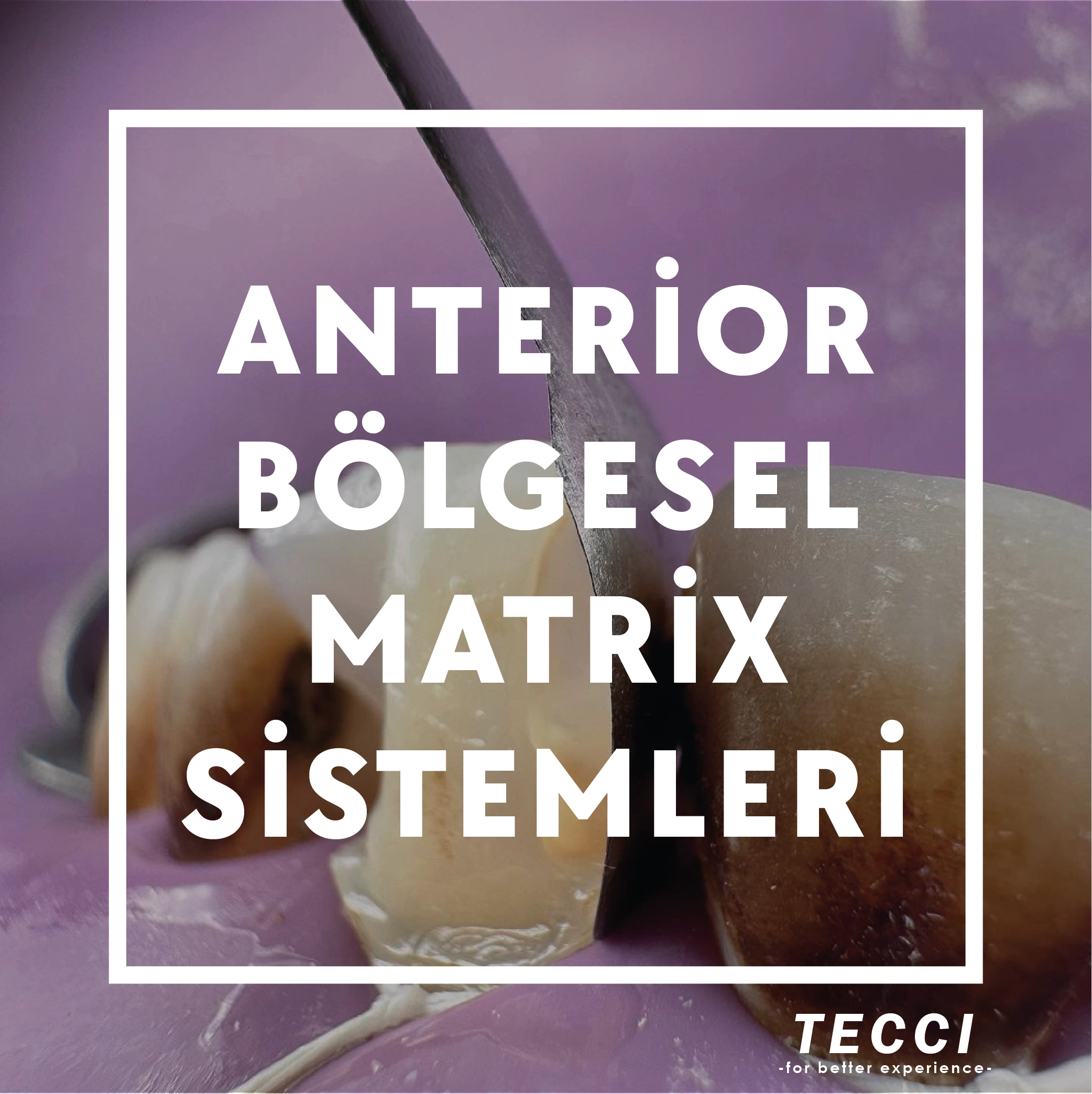 Tecci Anterior Bölgesel Matrix Sistemler,